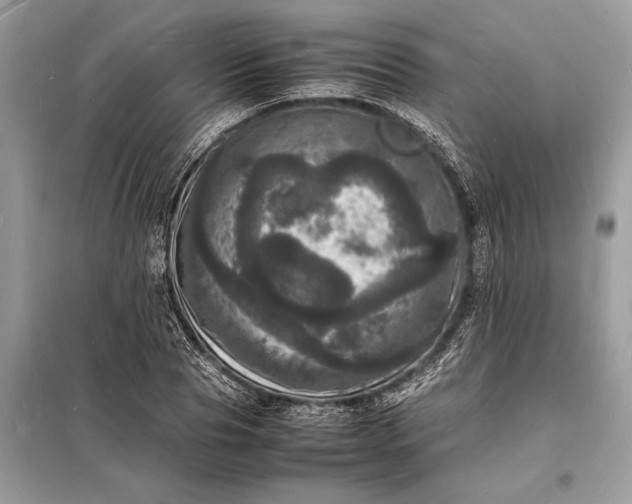 X0000098180929200805081021