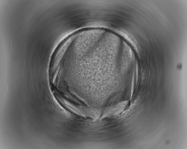 X0000098180943200805081021