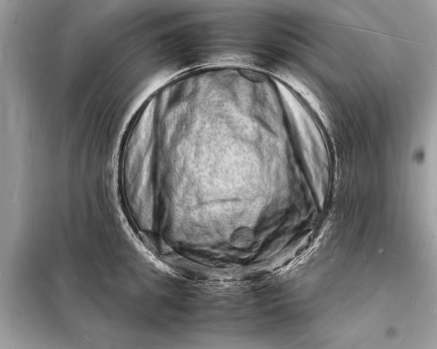 X0000098180949200805081021