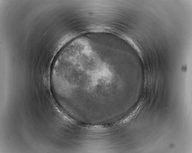 X0000098180986200805081020