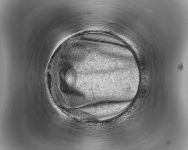 X0000098180991200805081020