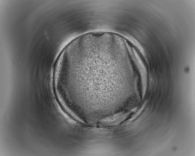 X0000098181006200805081020