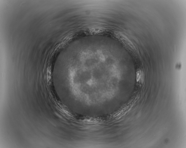 X0000098181011200805081019