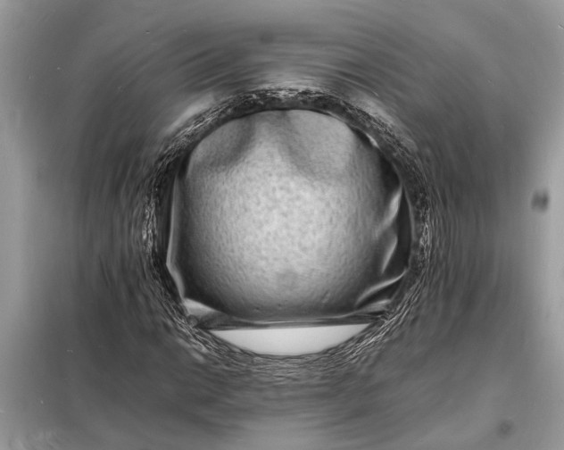 X0000098181014200805081019