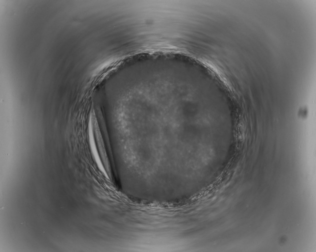 X0000098181063200805081019