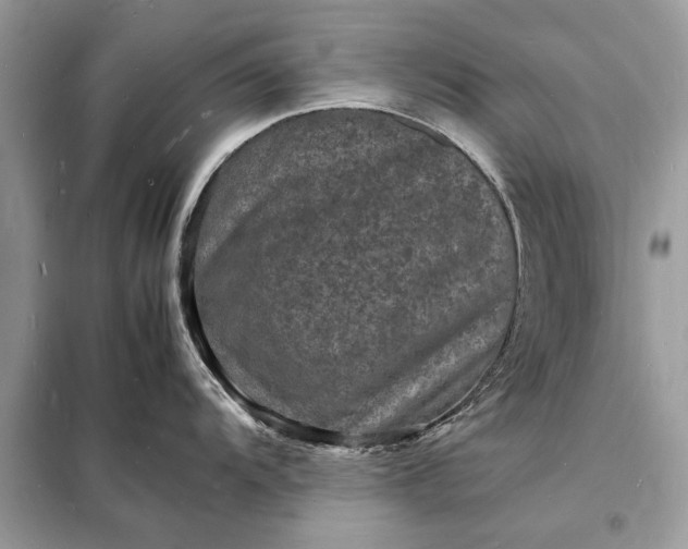 X0000098181104200805081018