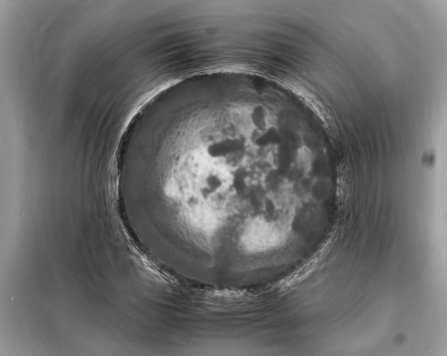 X0000098181117200805081018