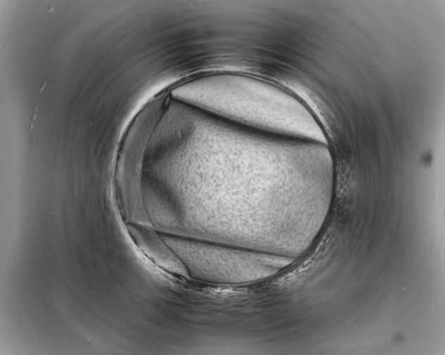 X0000098181139200805081018