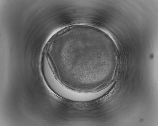 X0000098181147200805081018