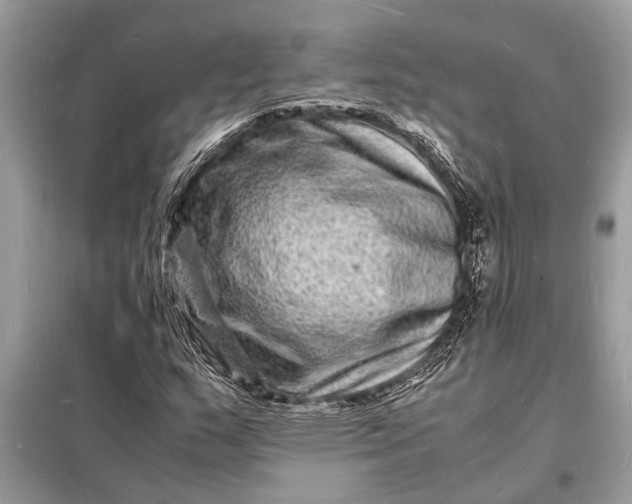 X0000098181159200805081018