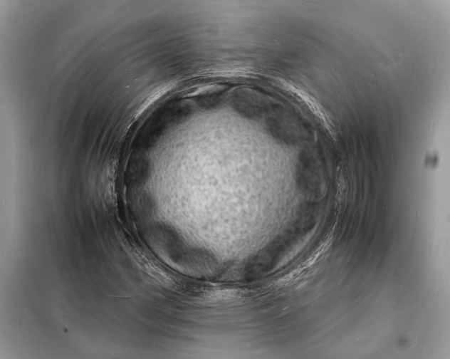 X0000098181162200805081018