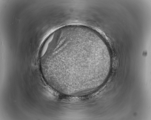 X0000098181167200805081017