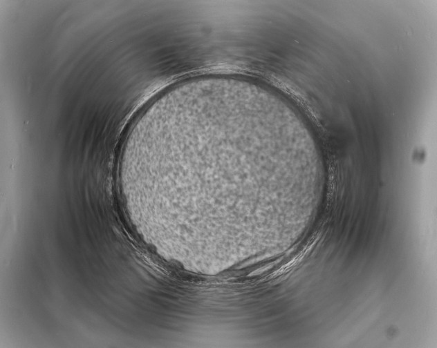 X0000098181170200805081017