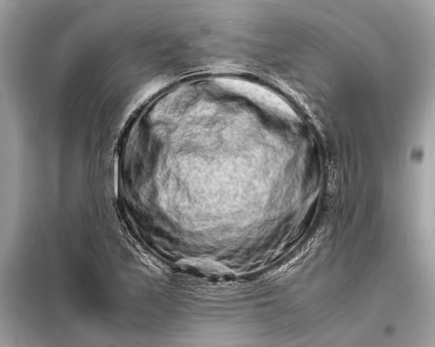 X0000098181171200805081017