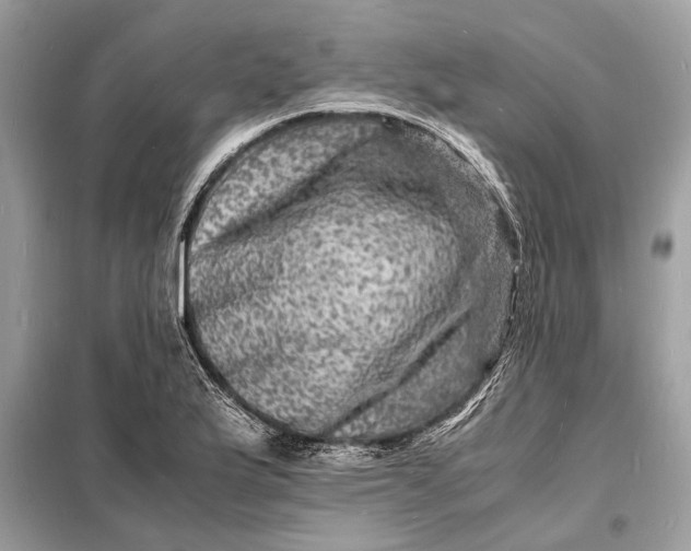 X0000098181175200805081017