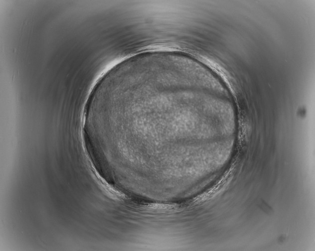 X0000098181179200805081017