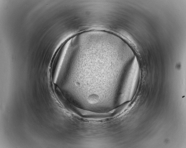 X0000098181190200805081017