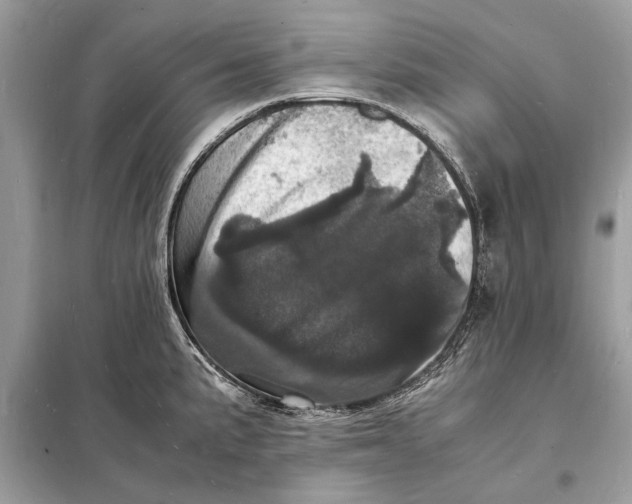 X0000098181191200805081017