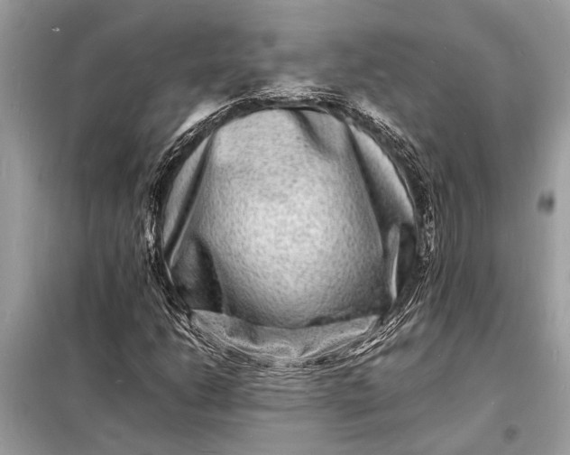 X0000098181206200805081016