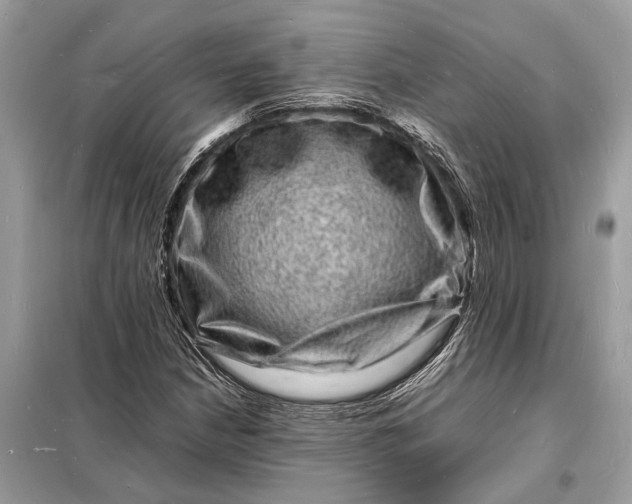 X0000098181210200805081016