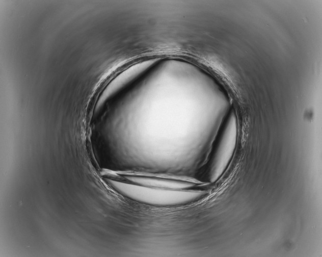 X0000098181212200805081016