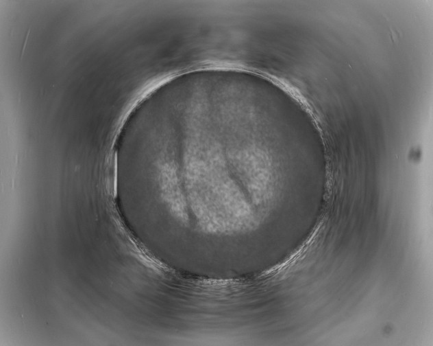 X0000098181223200805081017