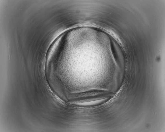 X0000098181228200805081017