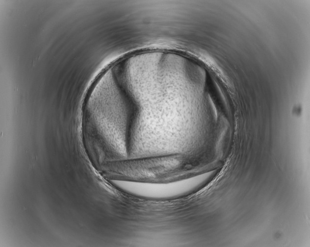 X0000098181232200805081017