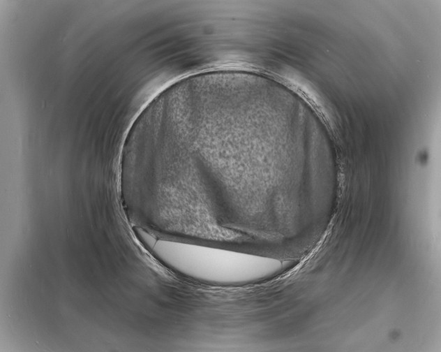 X0000098181236200805081017