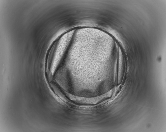 X0000098181237200805081017