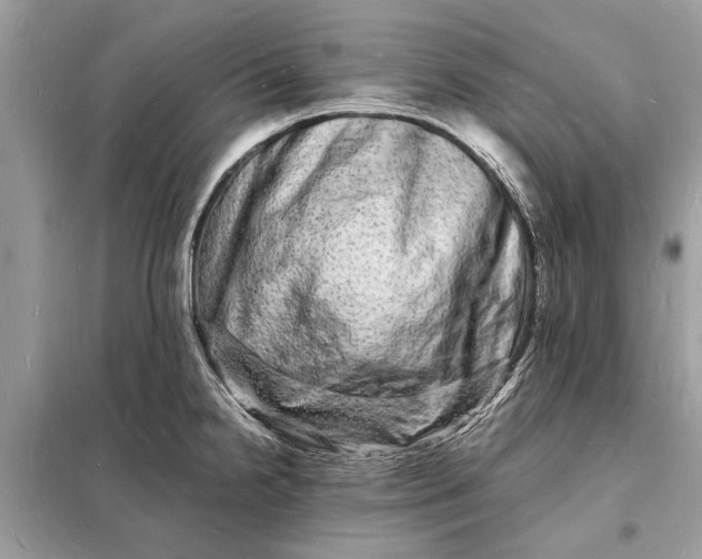 X0000098181238200805081017