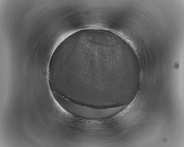 X0000098181239200805081017