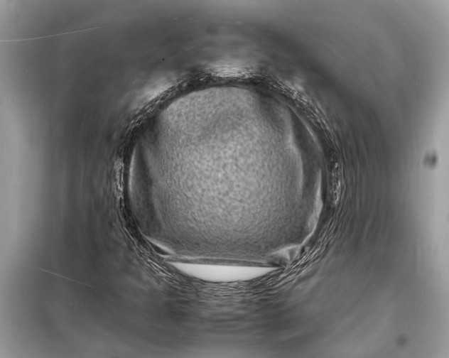 X0000098181301200805081015