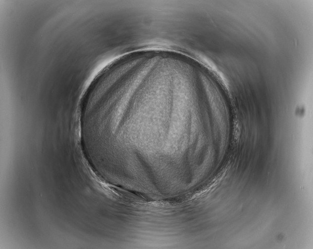 X0000098181368200805081015