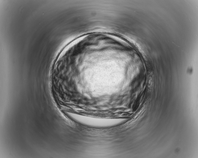 X0000098181375200805081014