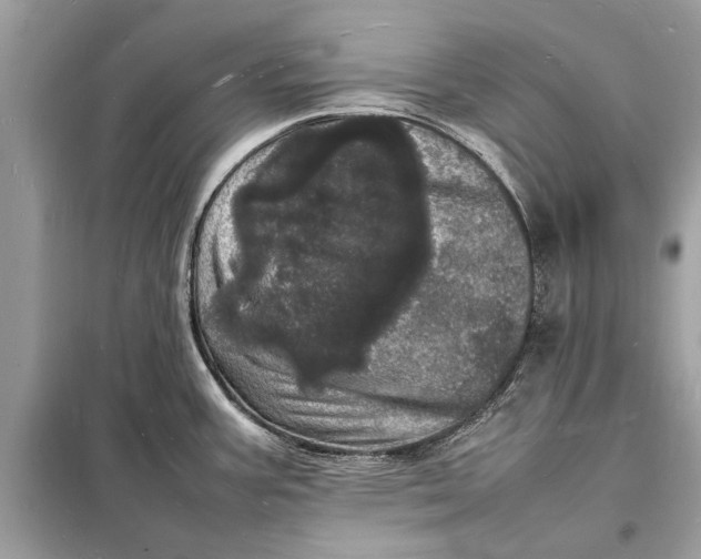 X0000098181387200805081014