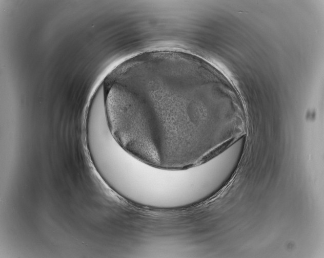 X0000098181392200805081014