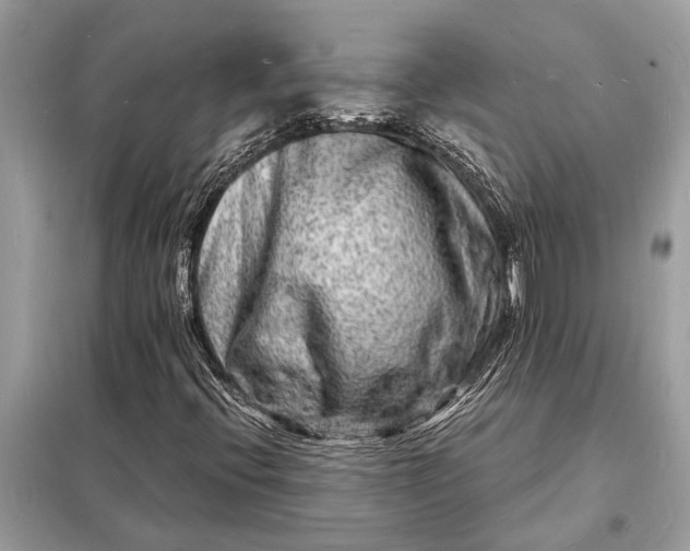 X0000098181396200805081013