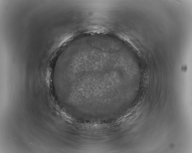 X0000098181399200805081013