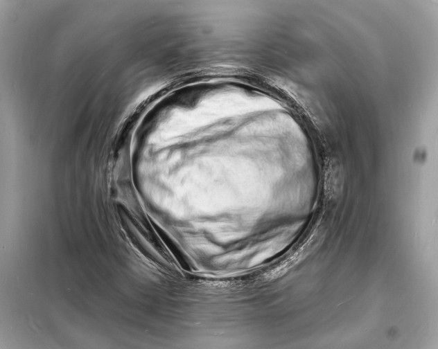 X0000098181402200805081013