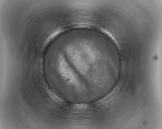 X0000098181403200805081013