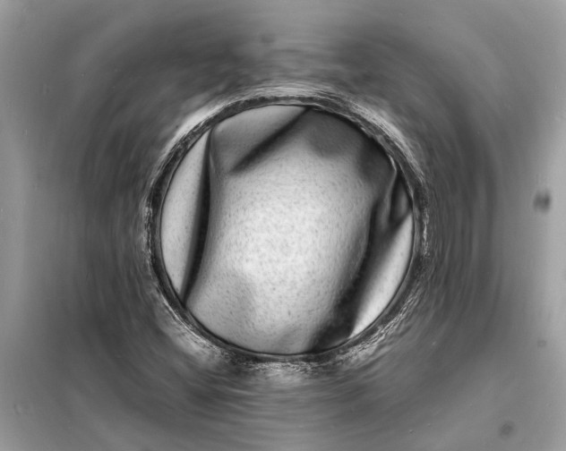 X0000098181404200805081013