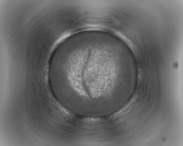 X0000098181411200805081014