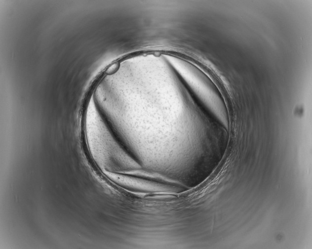 X0000098181416200805081014