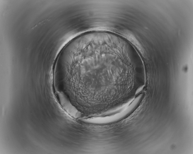 X0000098181428200805081014