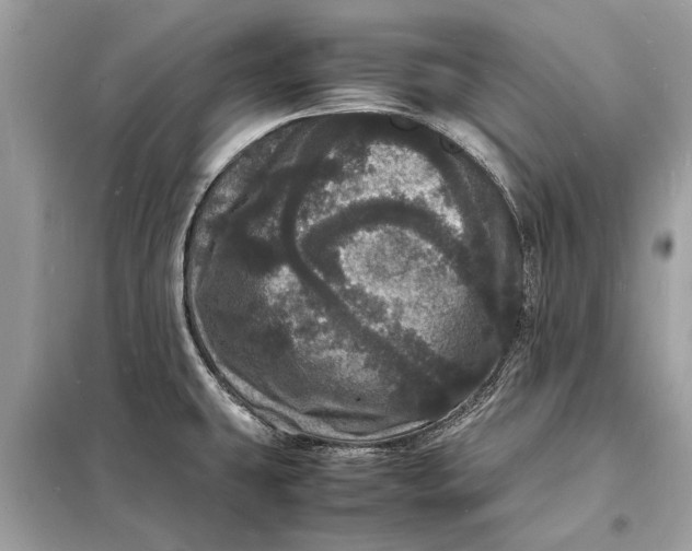 X0000098181431200805081014