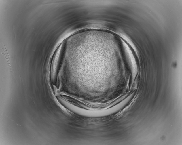 X0000098181437200805081014