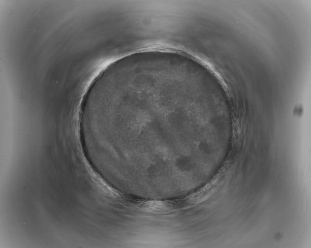 X0000098181463200805081013