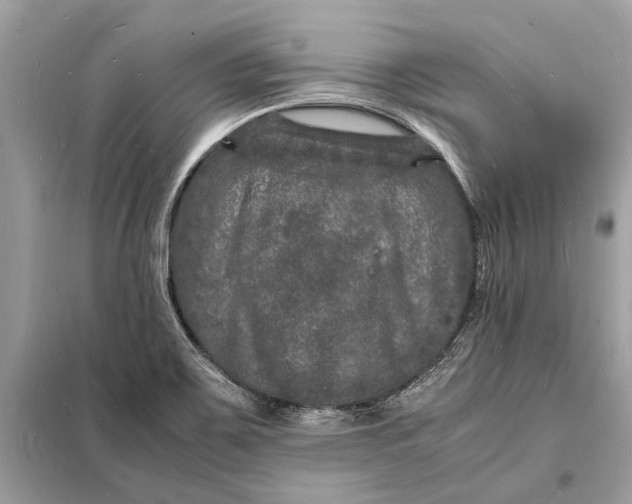 X0000098181467200805081013