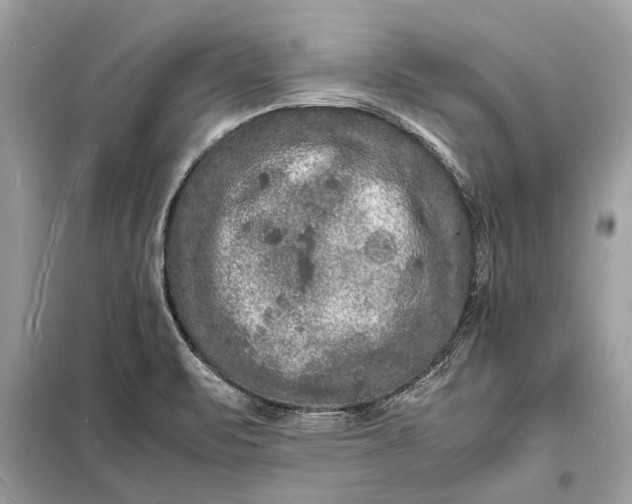 X0000098181471200805081013